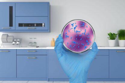 cucina e mano con un vetrino e una colonia di batteri
